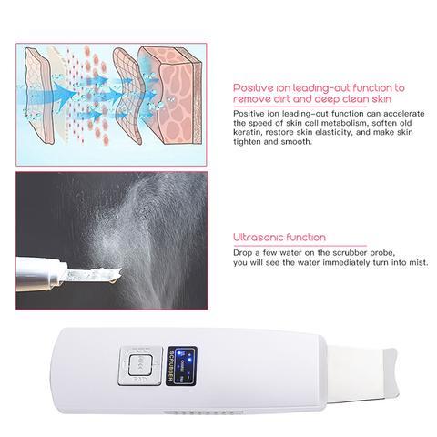 Ultrasonic Skin Scrubber – Deep Facial Cleansing & Blackhead Removal