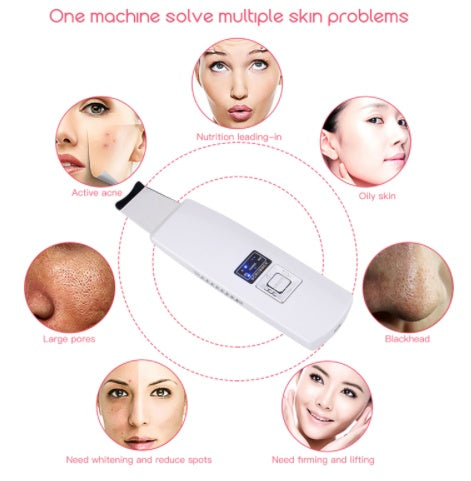 Ultrasonic Skin Scrubber – Deep Facial Cleansing & Blackhead Removal